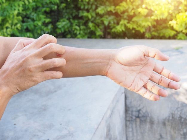 mano rascarse el brazo por picazón con enfermedades de la piel problemas de piel seca, dermatitis o eczema.