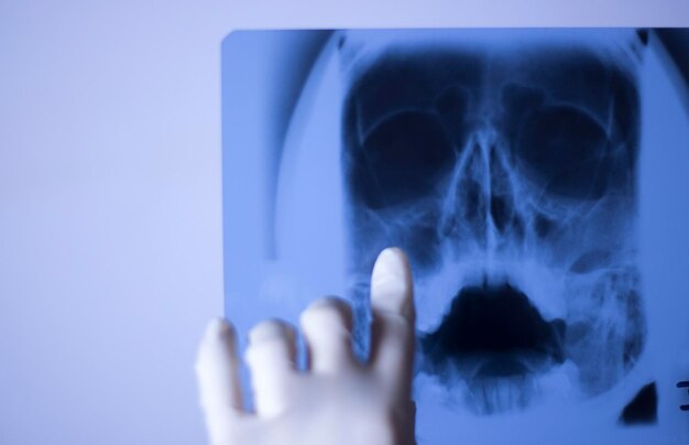 Foto mano recortada de una persona apuntando a una imagen de rayos x contra la pared