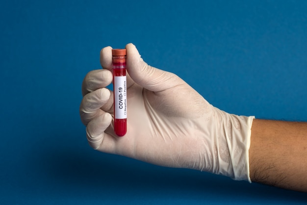 Mano sosteniendo un tubo de ensayo con muestra de sangre para coronavirus o análisis 2019-nCoV.