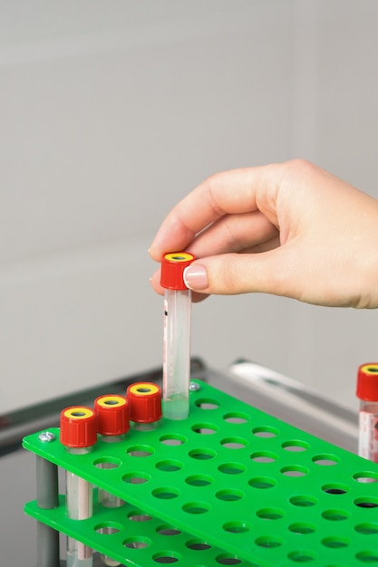 La mano del técnico de laboratorio o la enfermera toma el tubo de ensayo de sangre vacío de la rejilla en el laboratorio de investigación