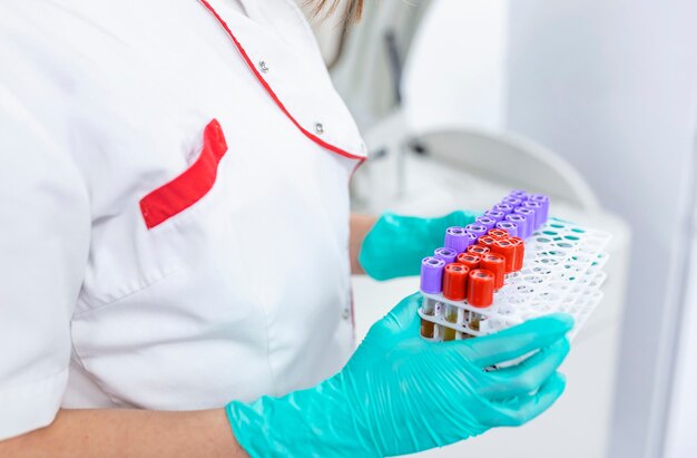 Mano de un técnico de laboratorio con tubos de sangre