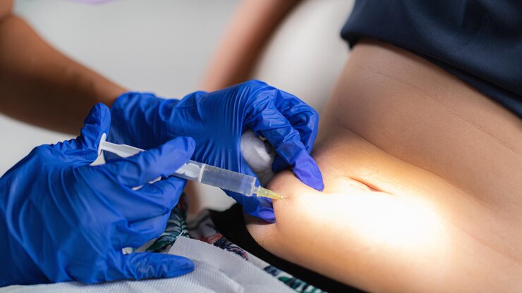 Foto manos cortadas de un médico inyectando el abdomen del paciente