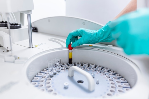 Manos de investigadora cargando muestras en centrifugadora en laboratorio