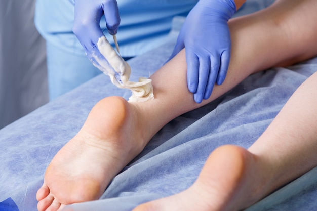 Las manos del médico esteticista hacen un shugaring junto al talón de la pierna izquierda a una mujer joven