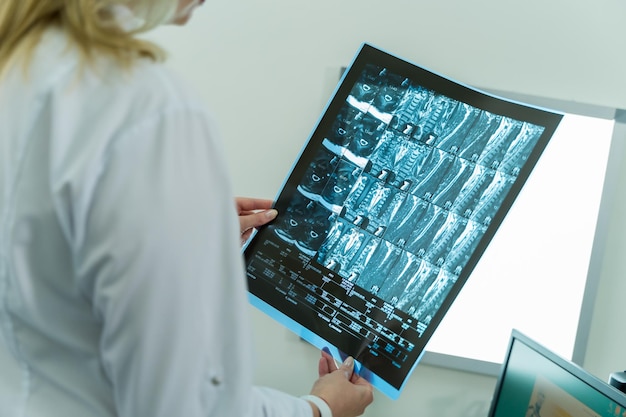Manos del médico con película de tomografía computarizada o rayos x Antecedentes de la sala médica
