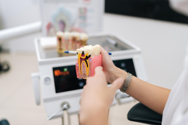 Manos de primer plano de una dentista mujer irreconocible sosteniendo un modelo de dientes y aprendiendo sobre dientes sanos.