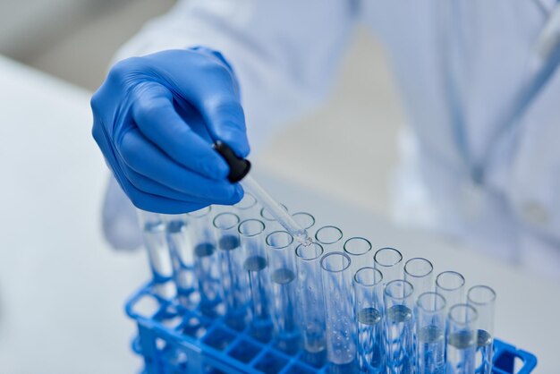 Manos tubo de ensaio e pesquisa farmacêutica para drogas medicina e desenvolvimento médico Cientista laboratório e descoberta para inovação extensão da vida e especialista profissional em bioquímica