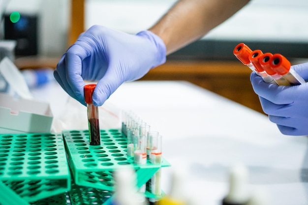 Foto manos usar guantes poner muestras de sangre ampollas botellas en los estantes en el laboratorio