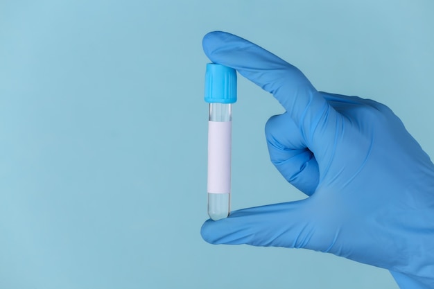 Mão com luvas médicas segura um tubo de ensaio em um fundo azul
