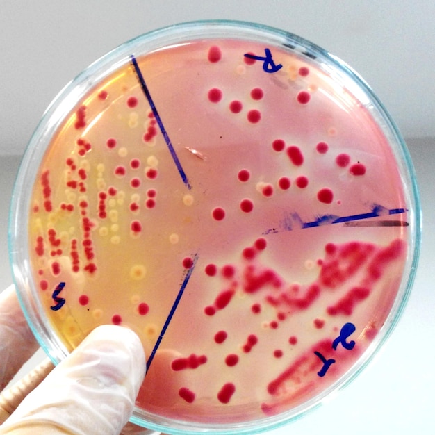 Foto mão cortada de um cientista segurando uma placa de agar com sangue em laboratório