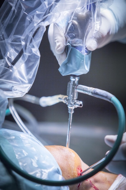 Mão cortada de um cirurgião que opera um paciente em um hospital