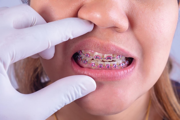 Foto mão cortada de um dentista examinando aparelhos dentários femininos