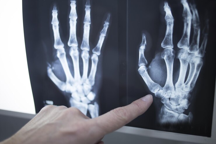 Foto mão cortada de um médico mostrando uma imagem de raios-x no hospital