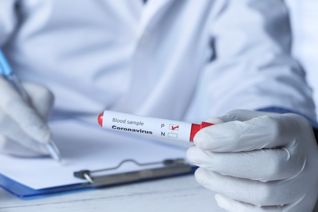 Foto mão de técnico de laboratório, segurando o tubo de análise de sangue