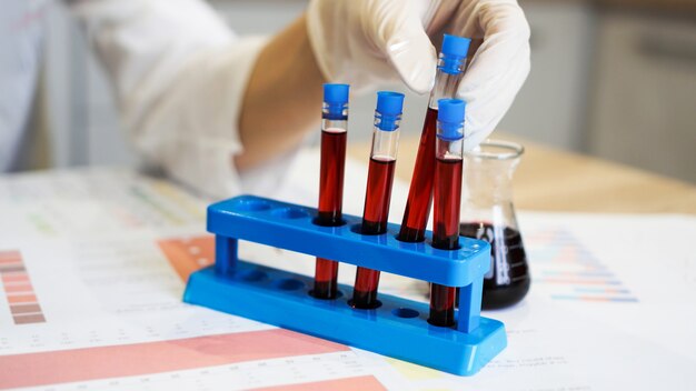 Mão de um científico tirando um tubo de amostra de sangue do estande. mulher trabalhando com amostras de sangue em laboratório, close-up