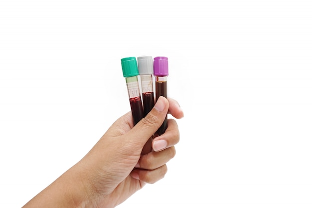 Foto mão de um médico segurando uma garrafa de amostra de sangue