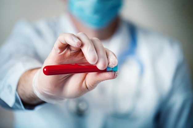 Mão de um médico segurando uma garrafa de amostra de sangue.