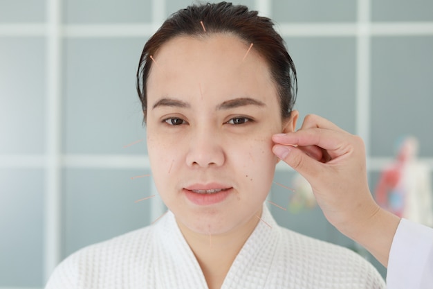 Foto mão do médico realizando terapia de acupuntura. mulher asiática em tratamento de acupuntura com uma linha de agulhas finas inseridas na pele do rosto no hospital clínico