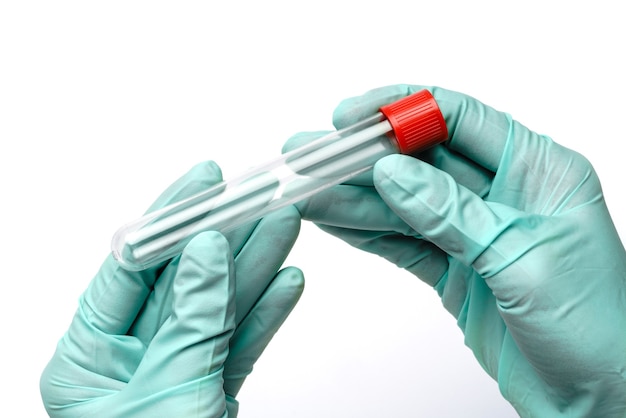 mão na luva de látex segurando amostra de sangue em tubo de ensaio close-up isolado no branco