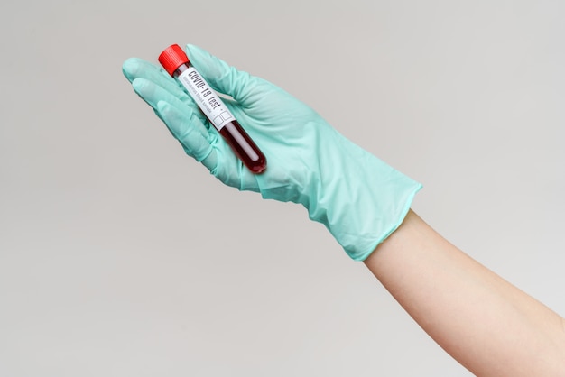 Mão na luva de látex, segurando o sangue no tubo de ensaio close-up