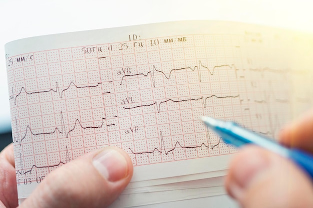 Mão na luva médica segurando uma caneta esferográfica Eletrocardiograma Close-up