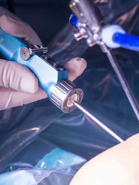 Mão recortada segurando equipamento médico ligado à perna do paciente
