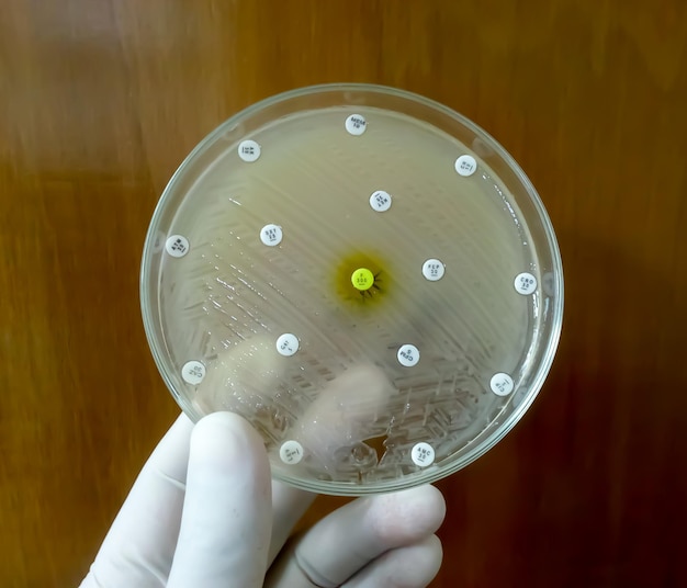 Mão segurando a placa de cultura de crescimento bacteriano mostrando sensibilidade a antibióticos em sua colônia