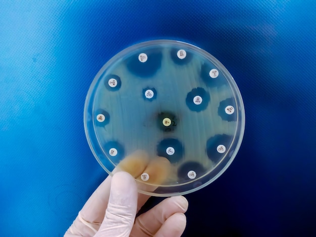 Mão segurando a placa de cultura de crescimento bacteriano mostrando sensibilidade a antibióticos em sua colônia