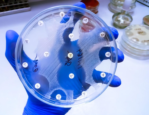 Mão segurando a placa de cultura de crescimento bacteriano mostrando sensibilidade a antibióticos em sua colônia