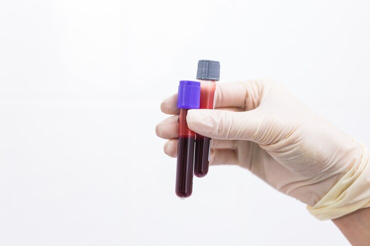 Foto mão segurando sangue em tubos de ensaio
