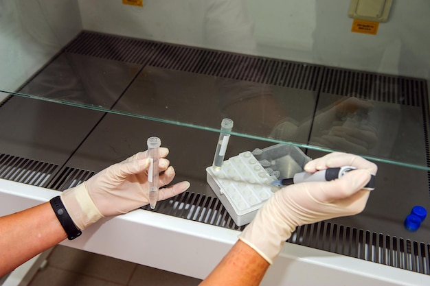 Foto mãos com tubos de ensaio closeup mãos em luvas médicas seguram tubos exame de sangue de conceito para a presença de um vírus teste de doença viral sangue humano no laboratório virusologia