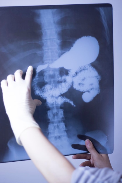 Mãos cortadas de mulher segurando imagem de raios-X