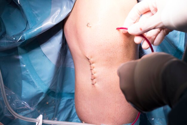 Foto mãos cortadas de um cirurgião que realiza uma cirurgia em um paciente