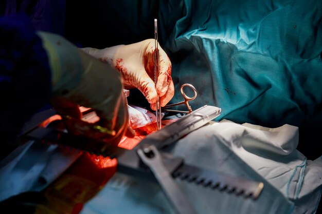 Mãos cortadas de um médico a operar um paciente.