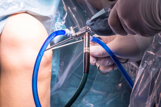 Mãos cortadas de um médico que opera o joelho de um paciente em um hospital