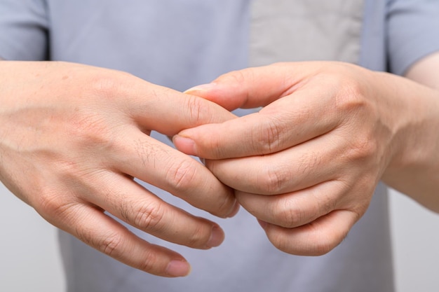 Mãos de homens que sofrem de dor nas articulações dos dedos Causas da gota de artrite reumatóide Cuidados de saúde e conceito médico