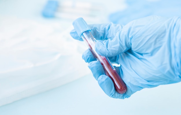 Foto mãos de um técnico de laboratório com um tubo de amostra de sangue