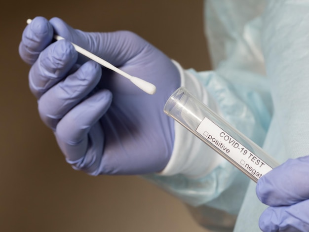 Mãos em luvas médicas segurando um cotonete de amostra oral e um tubo de ensaio para testes ambiciosos
