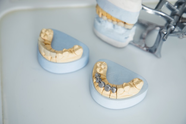 Maquete de mandíbula na mesa do dentista