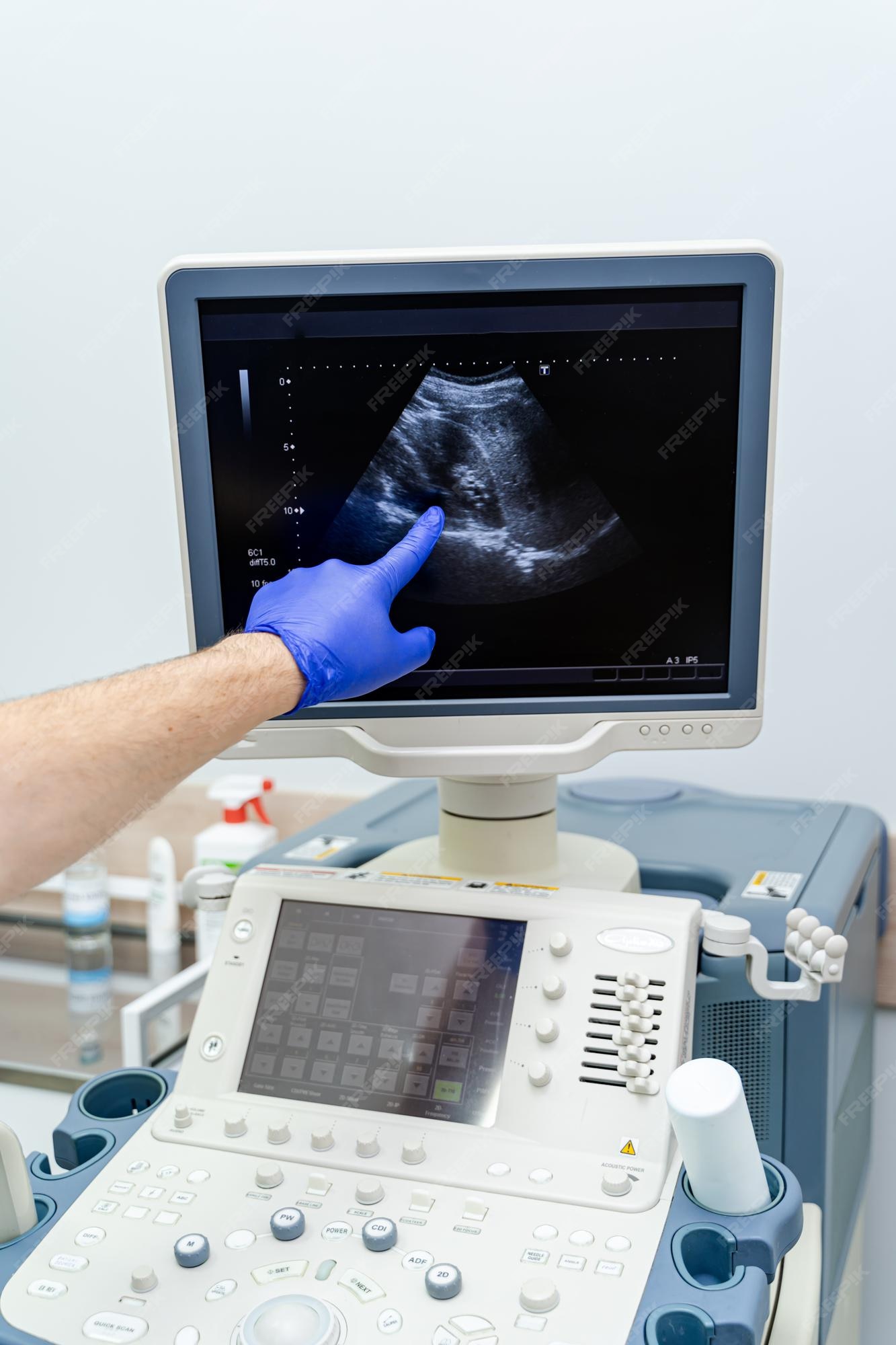 domingo trampa restante Máquina de ultrasonido y ecografía. equipo medico. concepto de salud.  enfoque selectivo del proceso. | Foto Premium