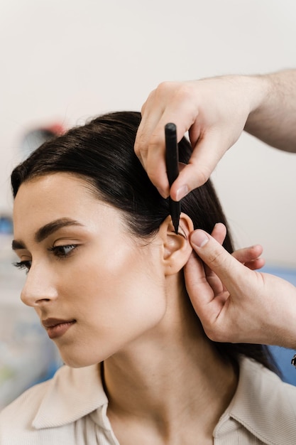 Marcado de otoplastia para la remodelación quirúrgica del pabellón auricular y la oreja Marcado de otoplastia antes de la cirugía de oreja Marcado dibujado por el cirujano en la oreja antes de la cirugía estética de otoplastia