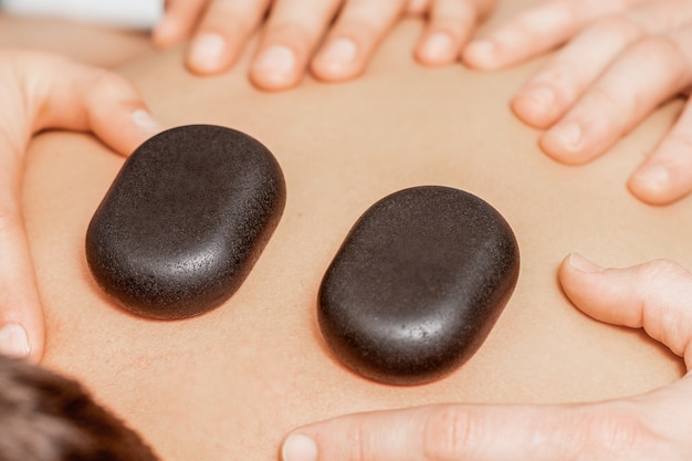 Masaje con piedras en la espalda del hombre.