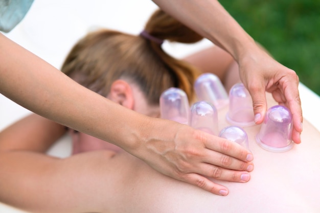 Masajista mujer haciendo masaje con ventosas en la espalda al aire libre. Tratamiento de ventosas en el spa. Medicina tradicional china.