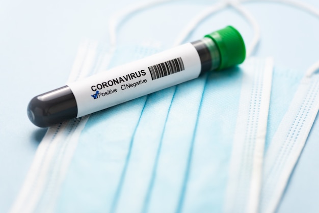 Máscara cirúrgica com tubo de ensaio de coronavírus positivo. Conceito de proteção contra coronavírus (COVID19). Máscara respiratória médica.