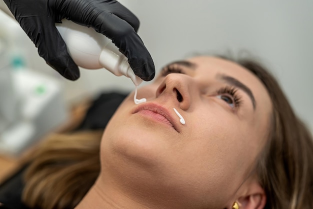 Foto master trägt nach der epilation des oberlippen-epilationskonzepts eine beruhigende creme auf