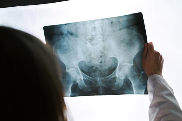 Foto médica examinando la radiografía de la pelvis en la oficina del hospital