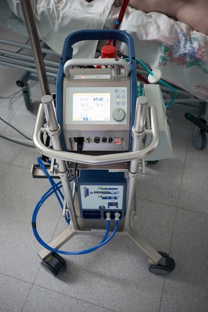 Medicamento. Oxigenación por membrana extracorpórea. Máquina ecmo trabajando en el departamento de cuidados intensivos. Closeup oxigenador de ECMO. Paciente gravemente enfermo en el fondo.