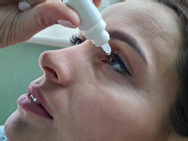 Foto medicina da visão e oftalmologia mulher aplicando colírio nos olhos