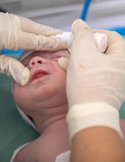 Foto médico aplicando colírio em recém-nascido