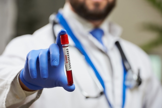 Un médico con una barba que demuestra una prueba de tubo de sangre de coronavirus en una mano.